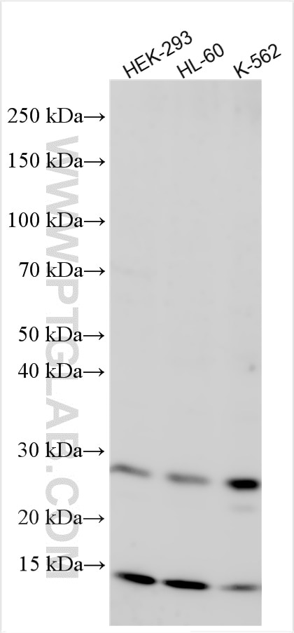 Western Blot (WB) analysis of various lysates using PPCDC Polyclonal antibody (16270-1-AP)