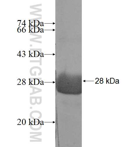 PPCDC fusion protein Ag9380 SDS-PAGE