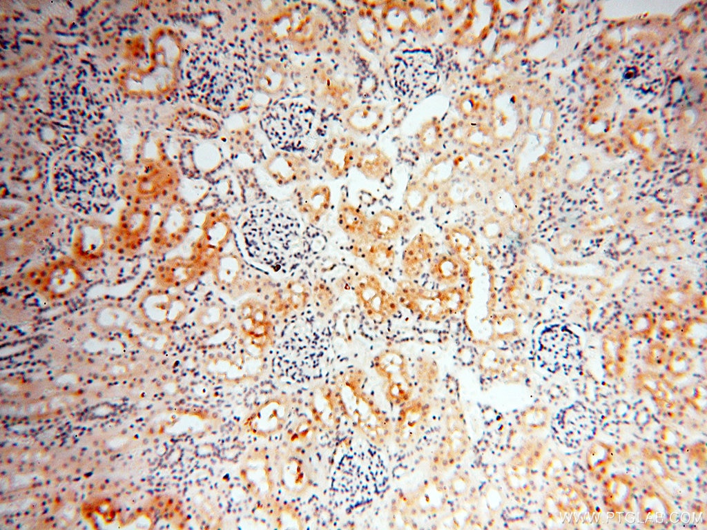 Immunohistochemistry (IHC) staining of human kidney tissue using PPCS Polyclonal antibody (18001-1-AP)