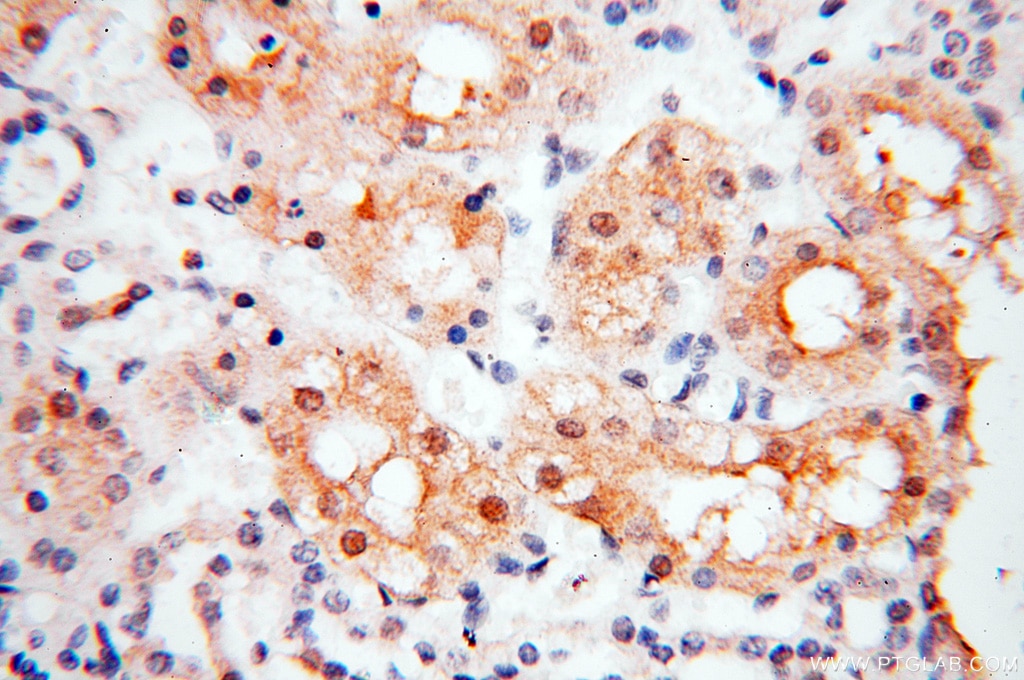 Immunohistochemistry (IHC) staining of human kidney tissue using PPCS Polyclonal antibody (18001-1-AP)