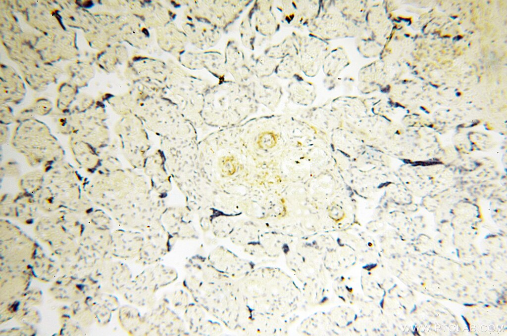 Immunohistochemistry (IHC) staining of human placenta tissue using PPCS Polyclonal antibody (18001-1-AP)