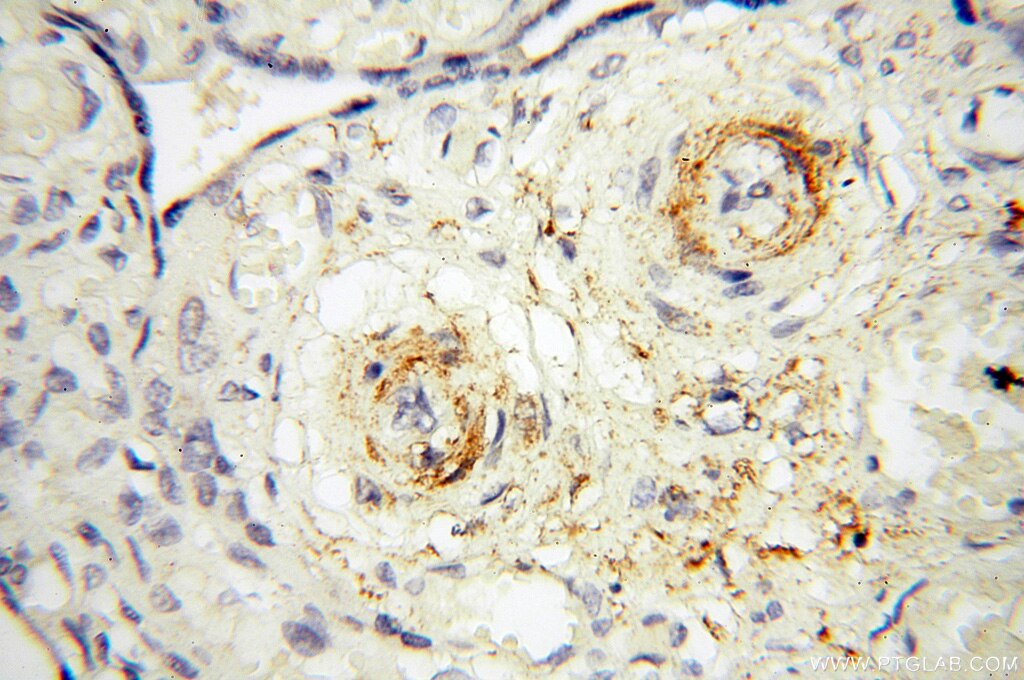 IHC staining of human placenta using 18001-1-AP