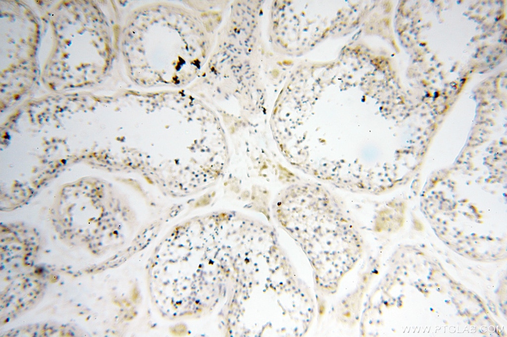 Immunohistochemistry (IHC) staining of human testis tissue using PPCS Polyclonal antibody (18001-1-AP)