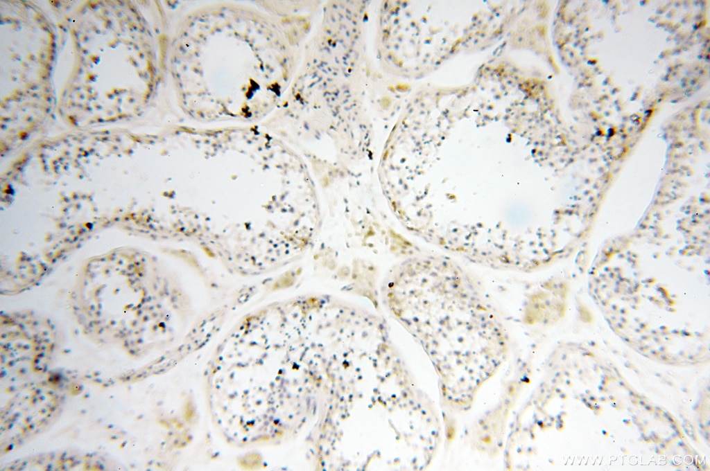 IHC staining of human testis using 18001-1-AP