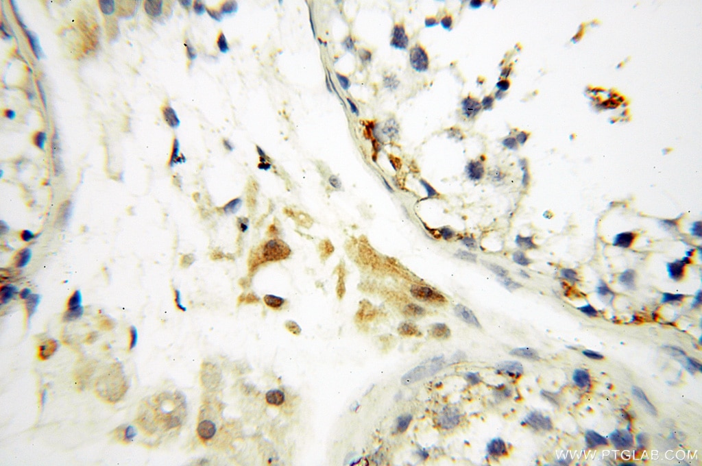 Immunohistochemistry (IHC) staining of human testis tissue using PPCS Polyclonal antibody (18001-1-AP)