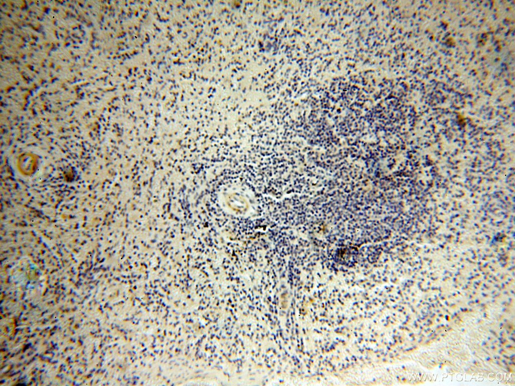 Immunohistochemistry (IHC) staining of human spleen tissue using PPCS Polyclonal antibody (18001-1-AP)