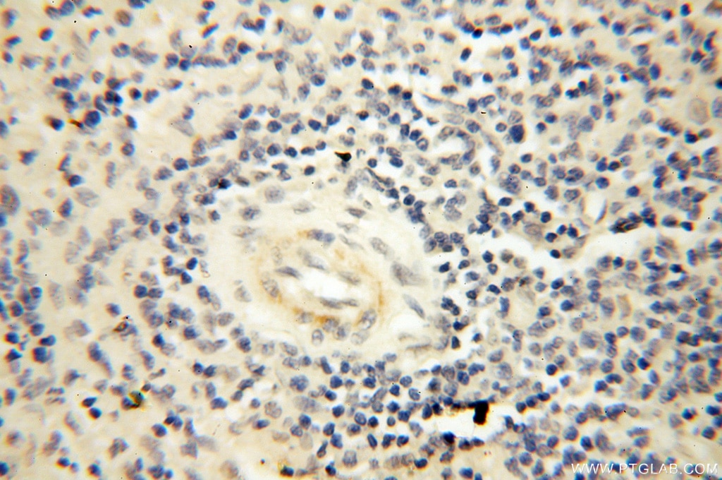 Immunohistochemistry (IHC) staining of human spleen tissue using PPCS Polyclonal antibody (18001-1-AP)