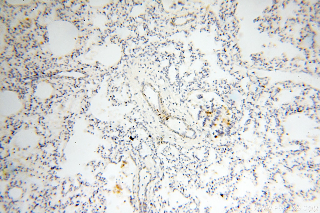 Immunohistochemistry (IHC) staining of human lung tissue using PPCS Polyclonal antibody (18001-1-AP)