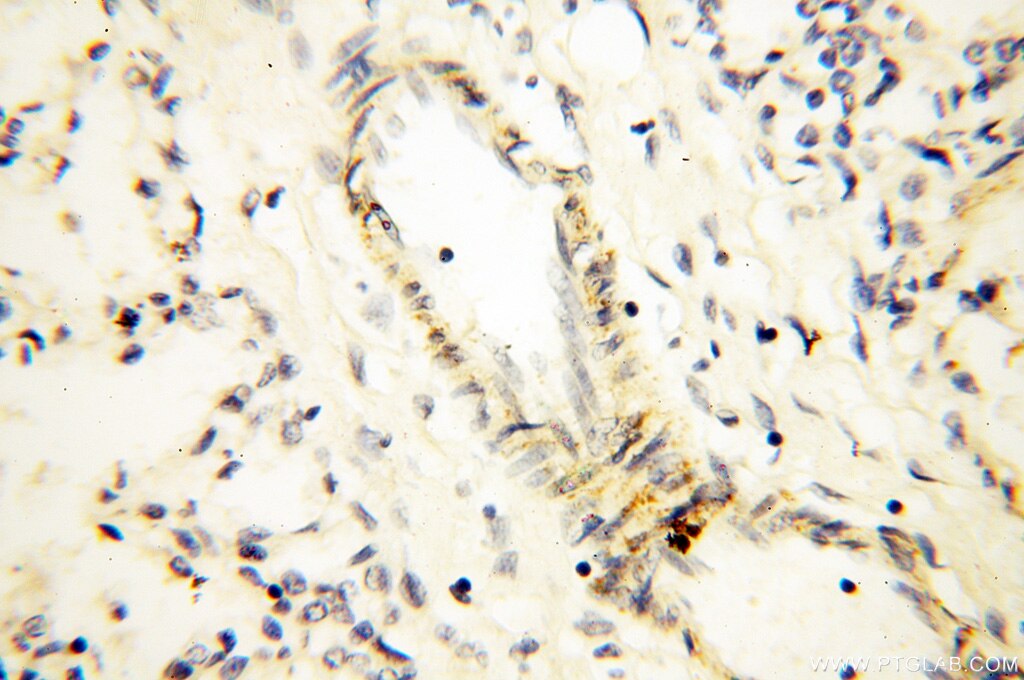 Immunohistochemistry (IHC) staining of human lung tissue using PPCS Polyclonal antibody (18001-1-AP)