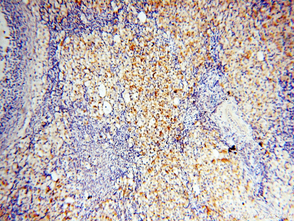 Immunohistochemistry (IHC) staining of human ovary tissue using PPCS Polyclonal antibody (18001-1-AP)