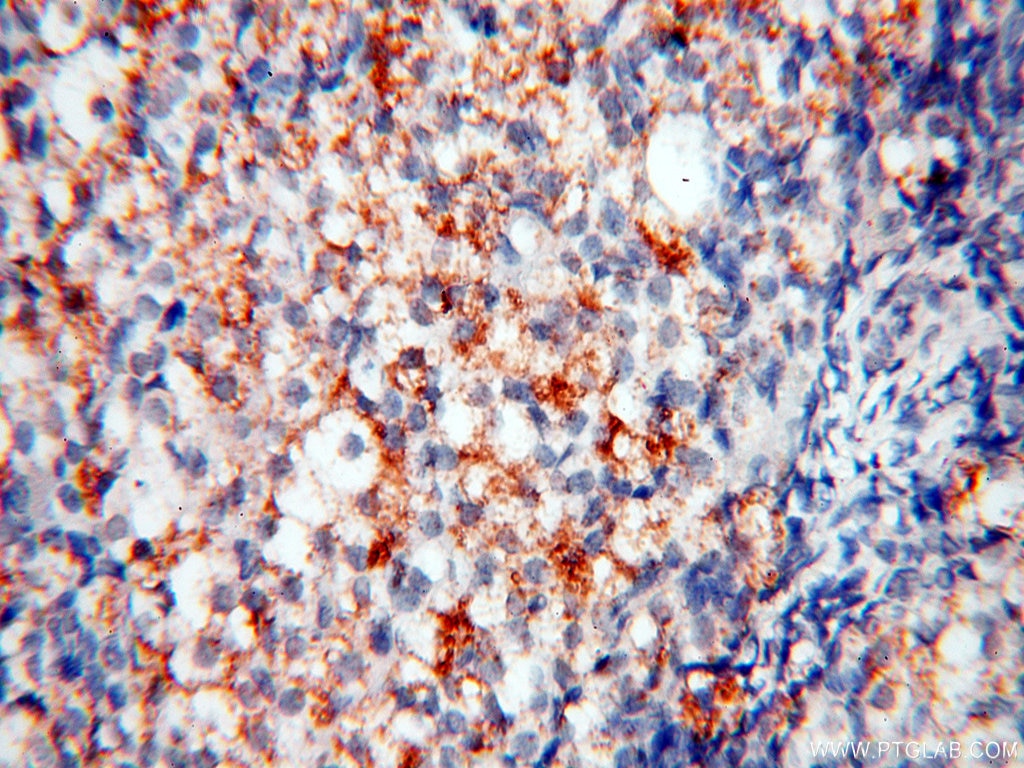 Immunohistochemistry (IHC) staining of human ovary tissue using PPCS Polyclonal antibody (18001-1-AP)