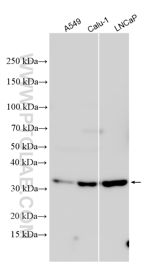 Western Blot (WB) analysis of various lysates using PPCS Polyclonal antibody (18001-1-AP)