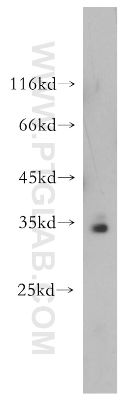 Western Blot (WB) analysis of HeLa cells using PPCS Polyclonal antibody (18001-1-AP)