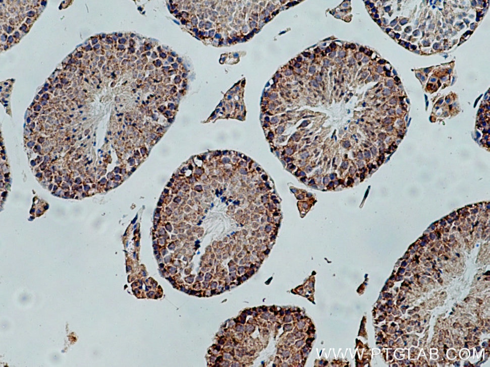 Immunohistochemistry (IHC) staining of mouse testis tissue using PPEF1 Polyclonal antibody (12875-1-AP)