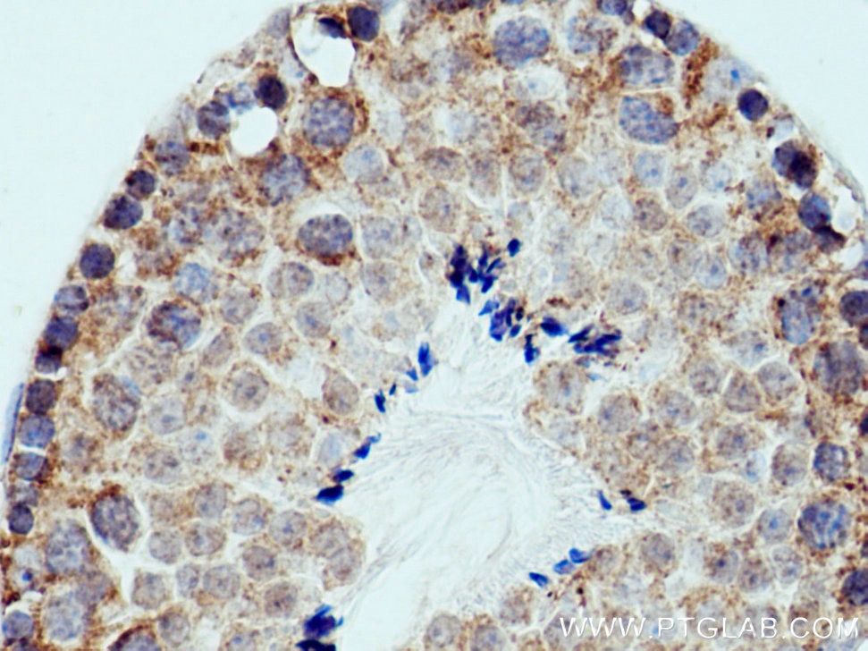 Immunohistochemistry (IHC) staining of mouse testis tissue using PPEF1 Polyclonal antibody (12875-1-AP)