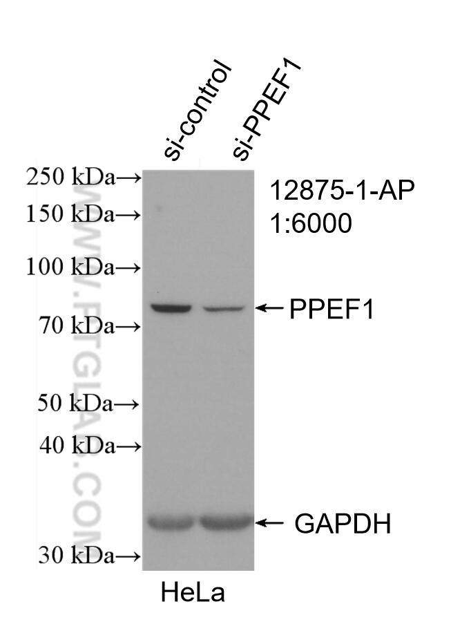Western Blot (WB) analysis of HeLa cells using PPEF1 Polyclonal antibody (12875-1-AP)