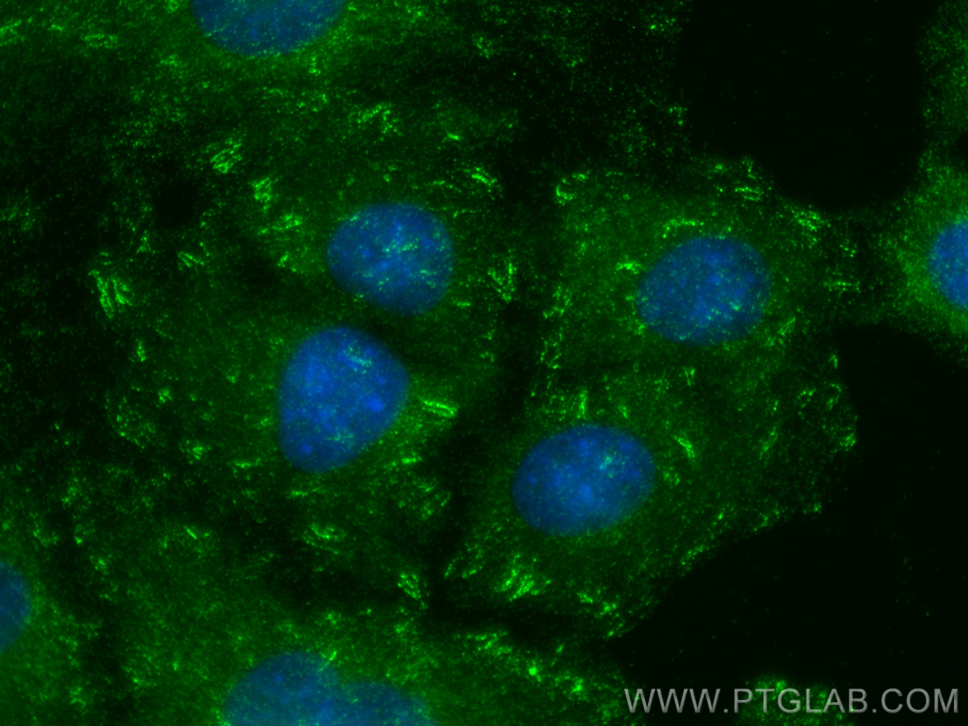 Immunofluorescence (IF) / fluorescent staining of A549 cells using Liprin Alpha 1 Polyclonal antibody (14175-1-AP)