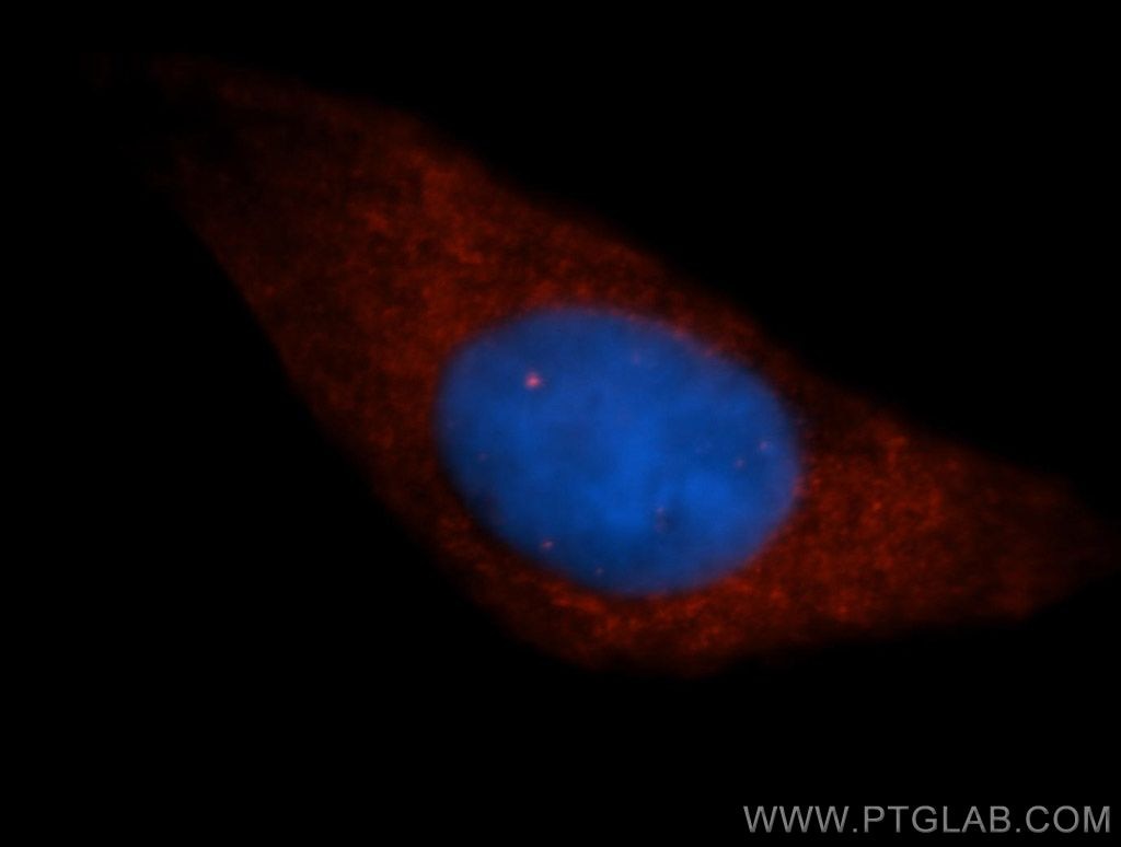 Immunofluorescence (IF) / fluorescent staining of HepG2 cells using Liprin Alpha 1 Polyclonal antibody (14175-1-AP)
