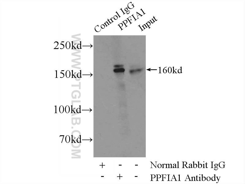 Immunoprecipitation (IP) experiment of MCF-7 cells using Liprin Alpha 1 Polyclonal antibody (14175-1-AP)