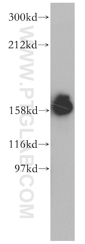 Western Blot (WB) analysis of HeLa cells using Liprin Alpha 1 Polyclonal antibody (14175-1-AP)