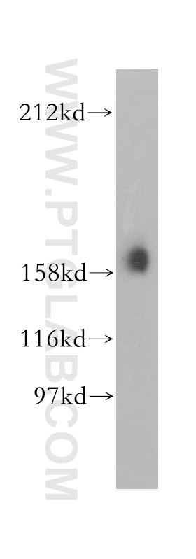 Western Blot (WB) analysis of MCF-7 cells using Liprin Alpha 1 Polyclonal antibody (14175-1-AP)
