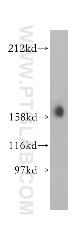 WB analysis of MCF-7 using 14175-1-AP