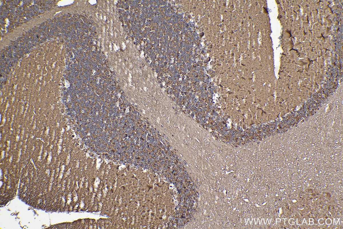 Immunohistochemistry (IHC) staining of mouse cerebellum tissue using PPFIA3 Polyclonal antibody (11492-1-AP)