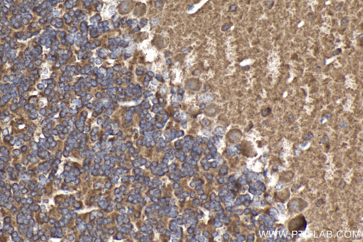 Immunohistochemistry (IHC) staining of mouse cerebellum tissue using PPFIA3 Polyclonal antibody (11492-1-AP)