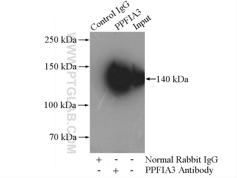 Immunoprecipitation (IP) experiment of mouse brain tissue using PPFIA3 Polyclonal antibody (11492-1-AP)