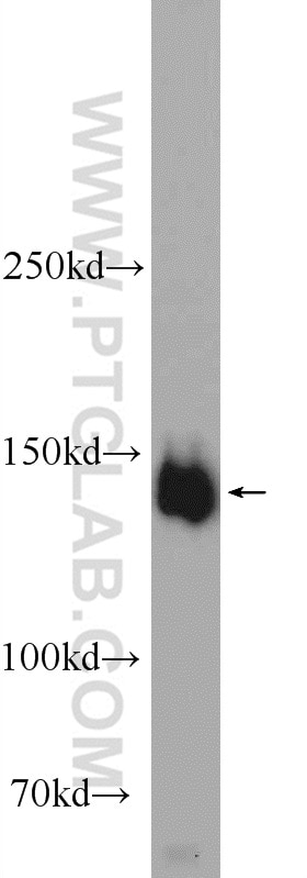 Western Blot (WB) analysis of mouse brain tissue using PPFIA3 Polyclonal antibody (11492-1-AP)