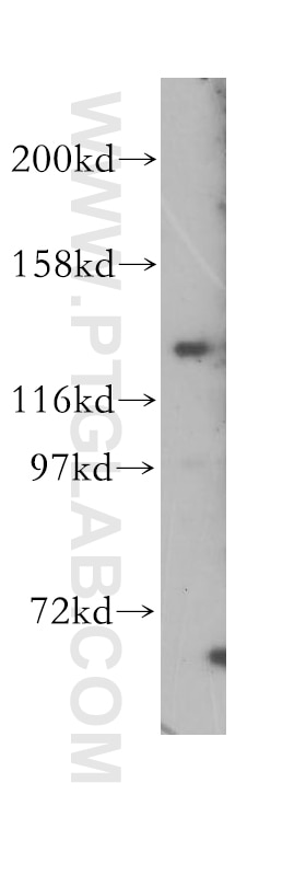 Western Blot (WB) analysis of HEK-293 cells using PPFIA3 Polyclonal antibody (11492-1-AP)