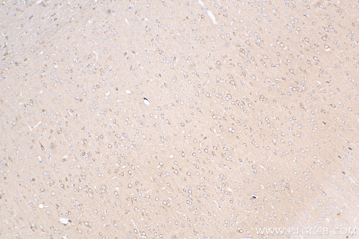 Immunohistochemistry (IHC) staining of rat brain tissue using PPFIA4 Polyclonal antibody (25295-1-AP)
