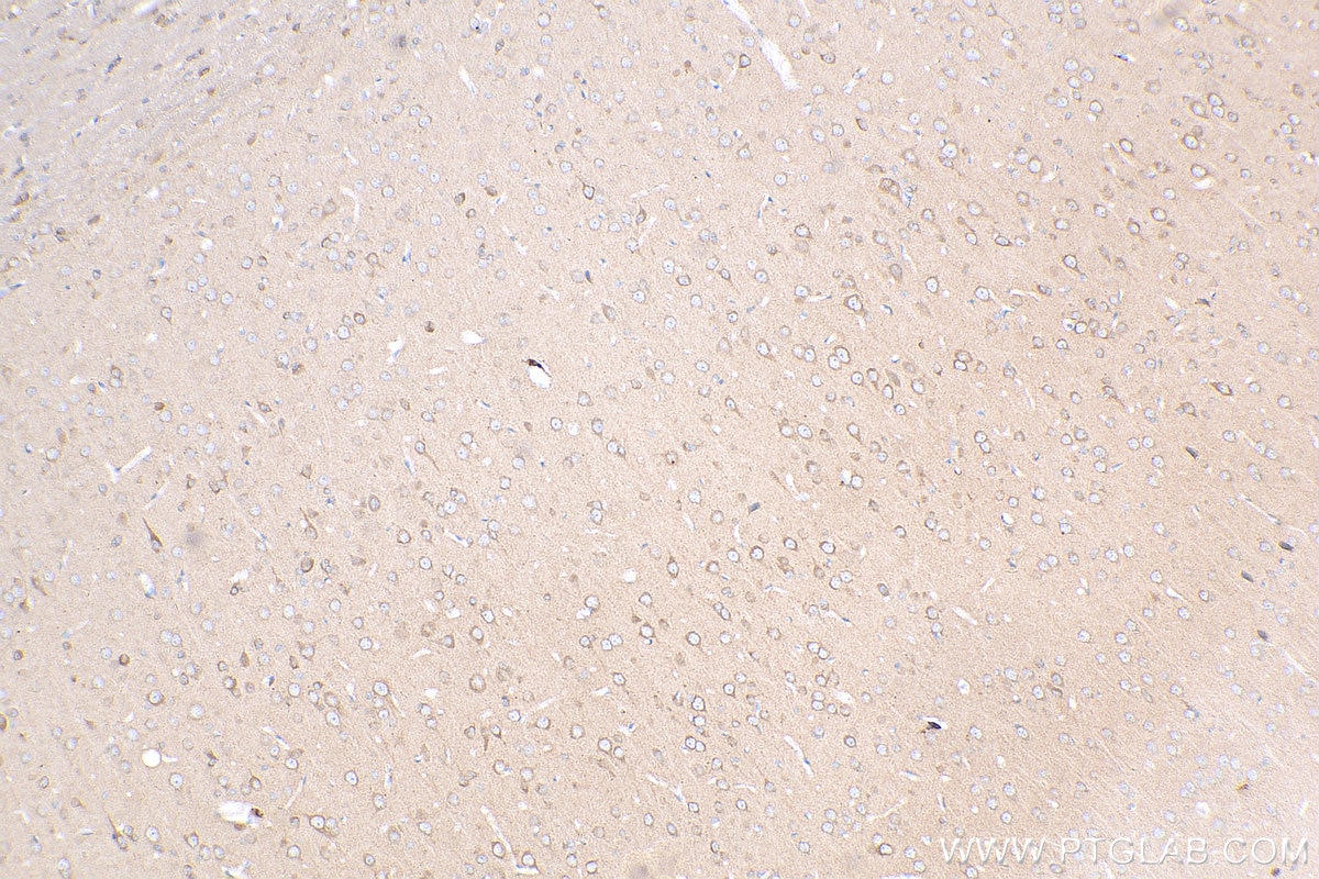 Immunohistochemistry (IHC) staining of rat brain tissue using PPFIA4 Polyclonal antibody (25295-1-AP)
