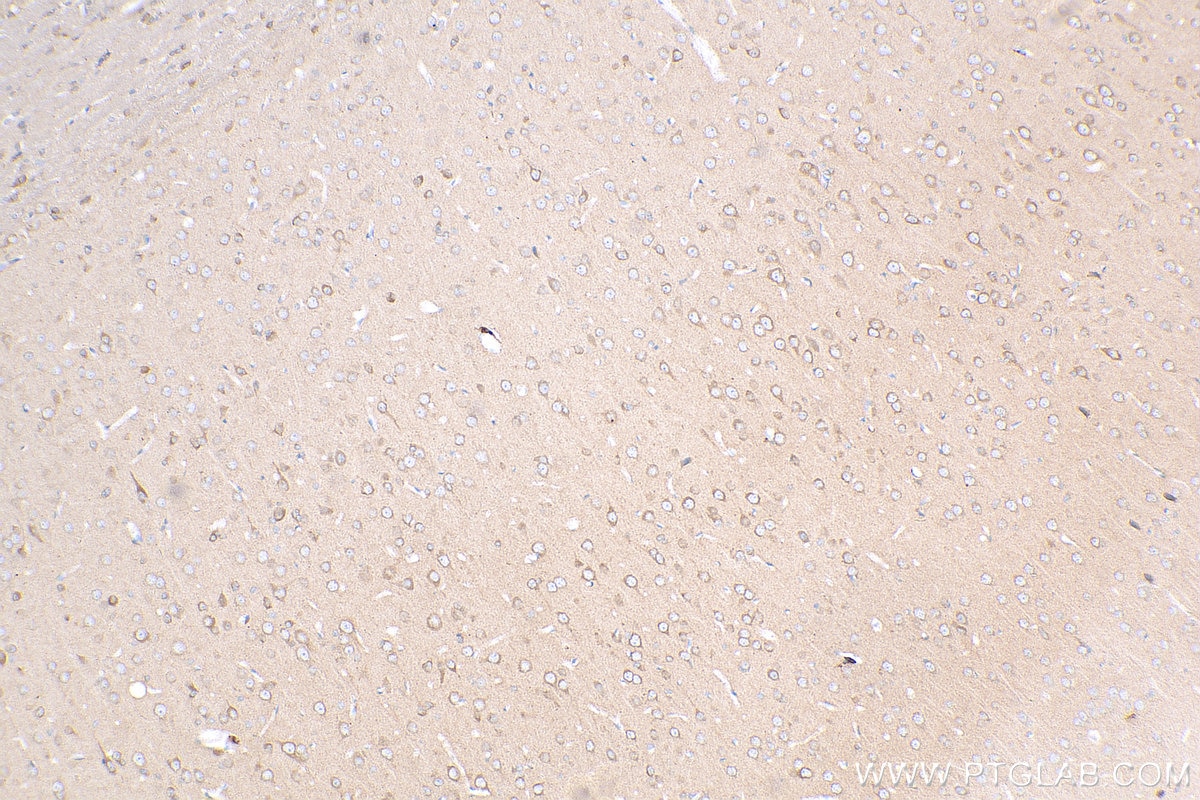 IHC staining of rat brain using 25295-1-AP