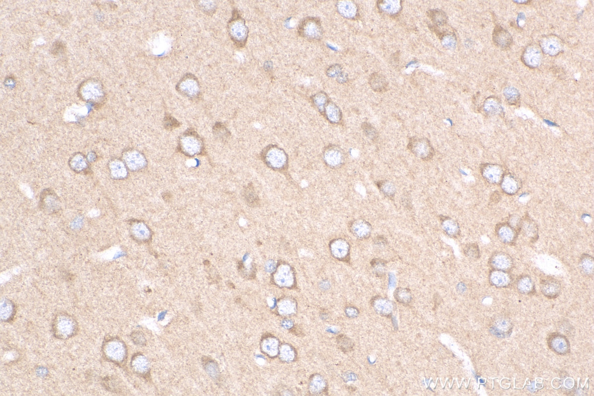 IHC staining of rat brain using 25295-1-AP