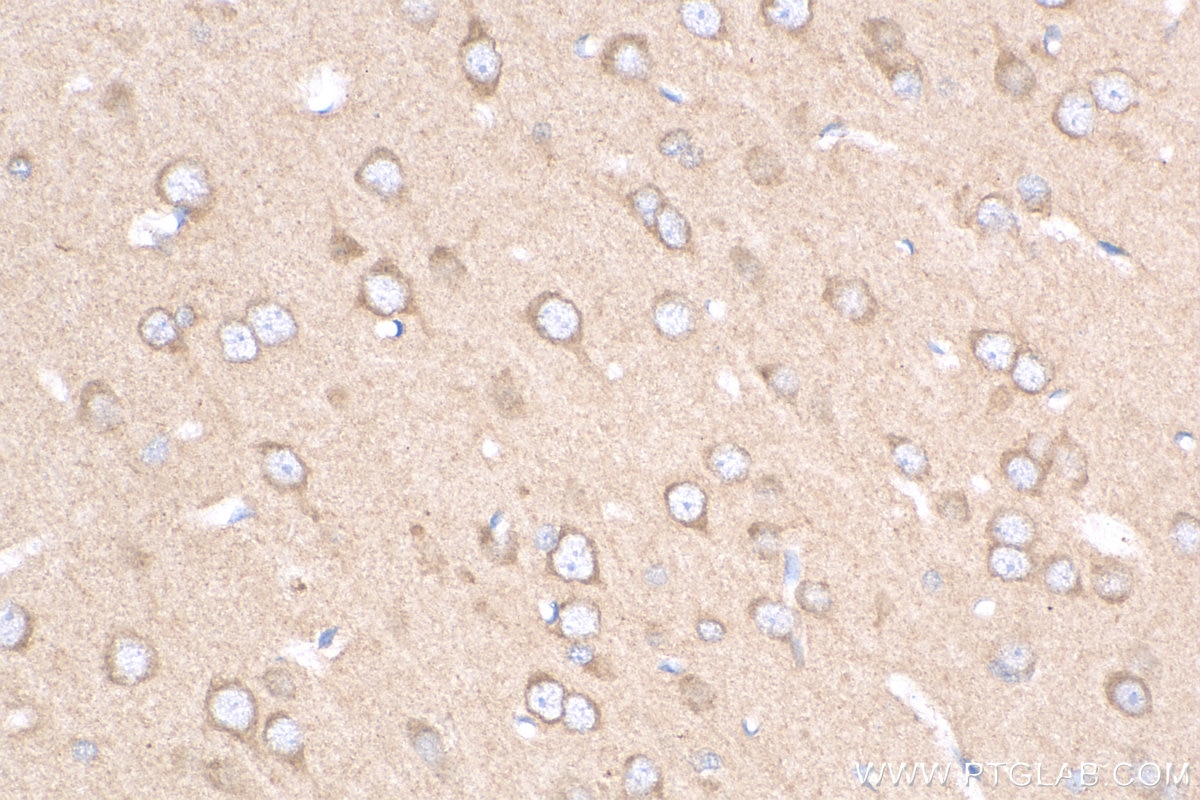 Immunohistochemistry (IHC) staining of rat brain tissue using PPFIA4 Polyclonal antibody (25295-1-AP)