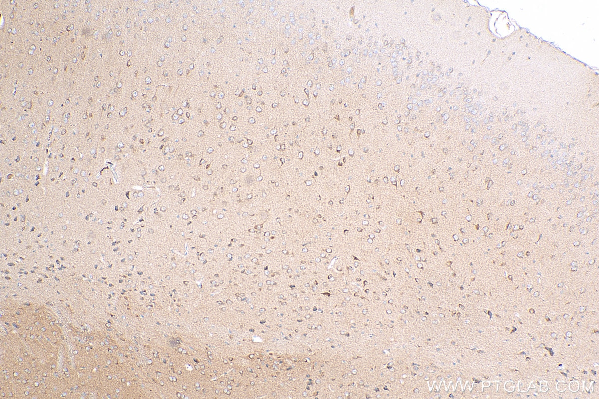 IHC staining of mouse brain using 25295-1-AP