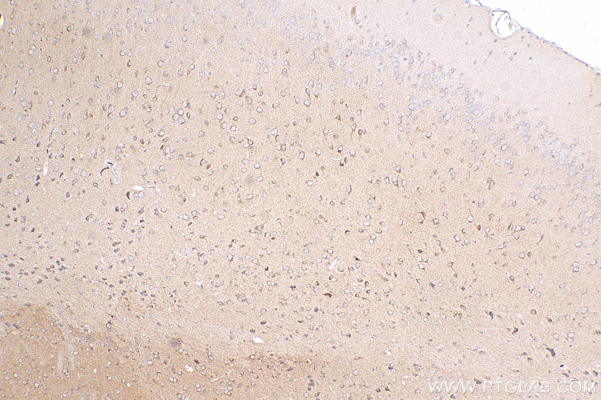 Immunohistochemistry (IHC) staining of mouse brain tissue using PPFIA4 Polyclonal antibody (25295-1-AP)