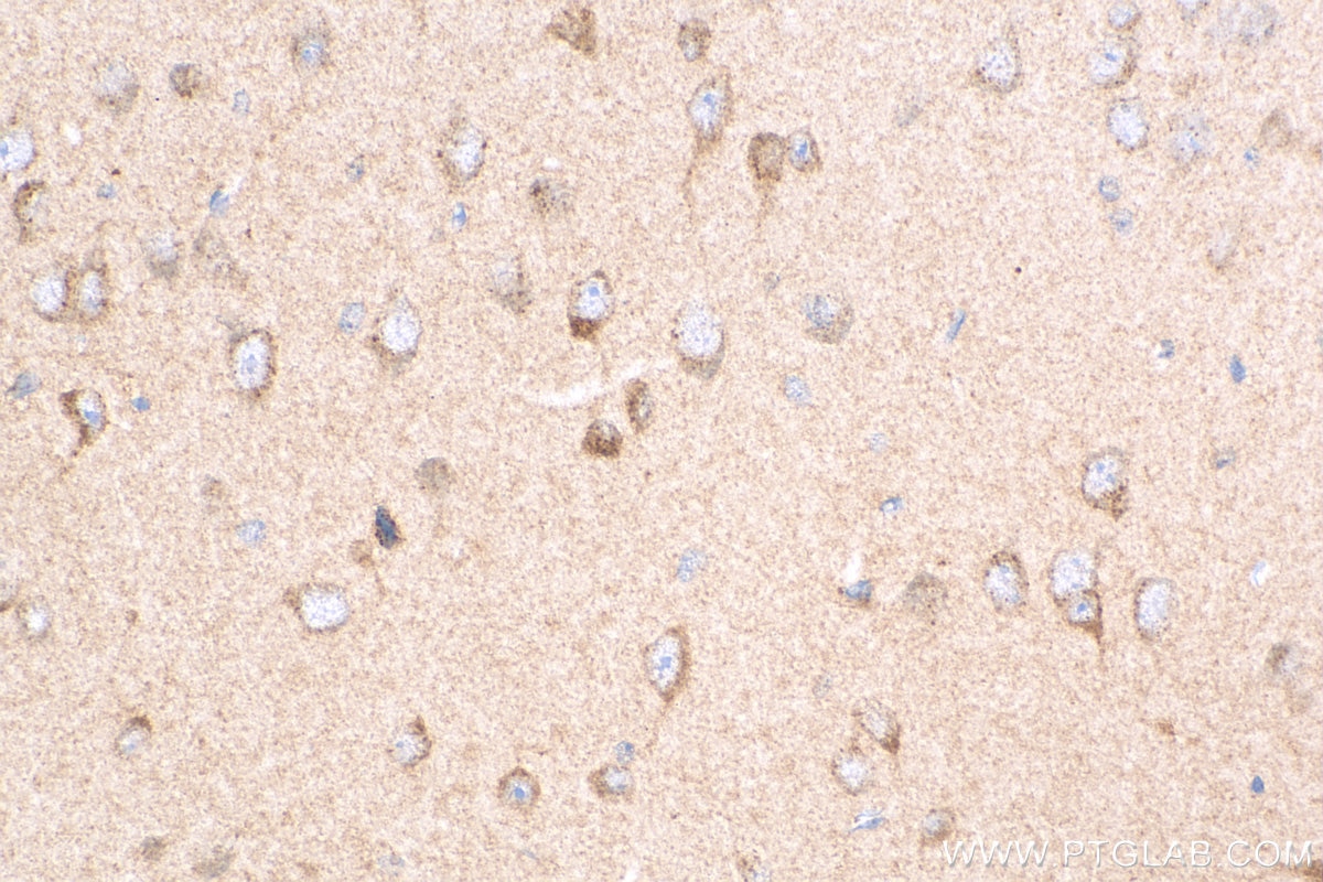 Immunohistochemistry (IHC) staining of mouse brain tissue using PPFIA4 Polyclonal antibody (25295-1-AP)