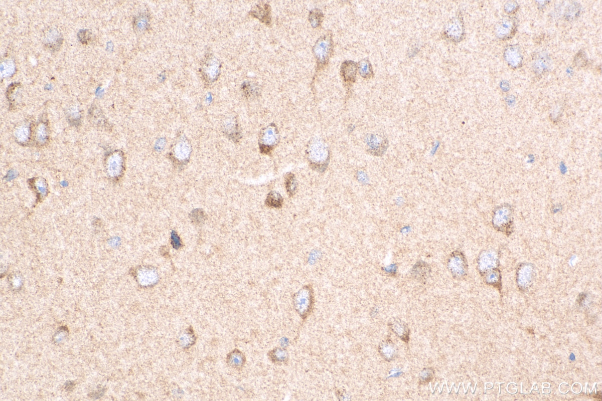 IHC staining of mouse brain using 25295-1-AP