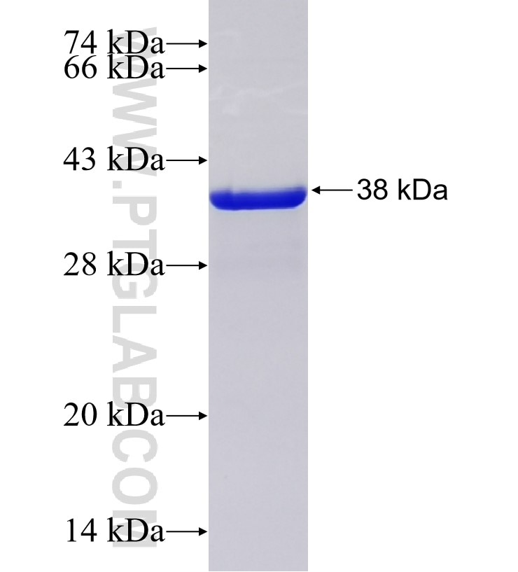 PPFIA4 fusion protein Ag18130 SDS-PAGE