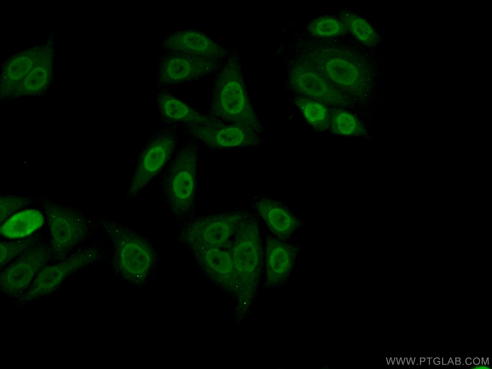 Immunofluorescence (IF) / fluorescent staining of HepG2 cells using PPFIBP1 Polyclonal antibody (13961-1-AP)