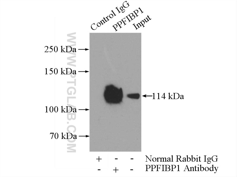 Immunoprecipitation (IP) experiment of HepG2 cells using PPFIBP1 Polyclonal antibody (13961-1-AP)