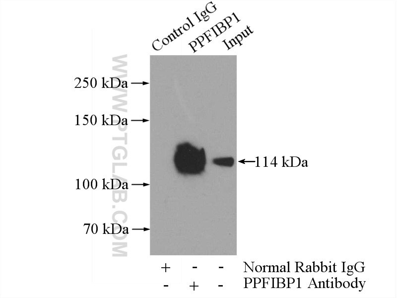 Immunoprecipitation (IP) experiment of HepG2 cells using PPFIBP1 Polyclonal antibody (13961-1-AP)