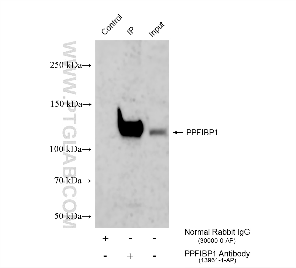 Immunoprecipitation (IP) experiment of Neuro-2a cells using PPFIBP1 Polyclonal antibody (13961-1-AP)