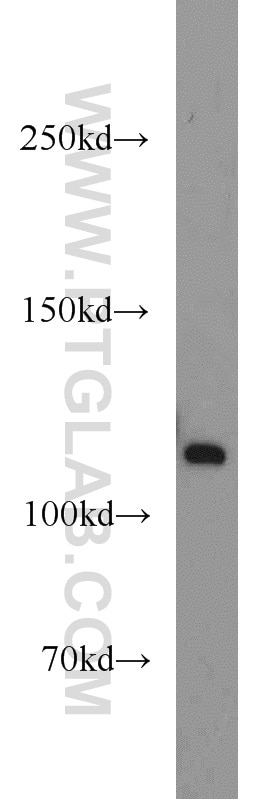 Western Blot (WB) analysis of DU 145 cells using PPFIBP1 Polyclonal antibody (13961-1-AP)