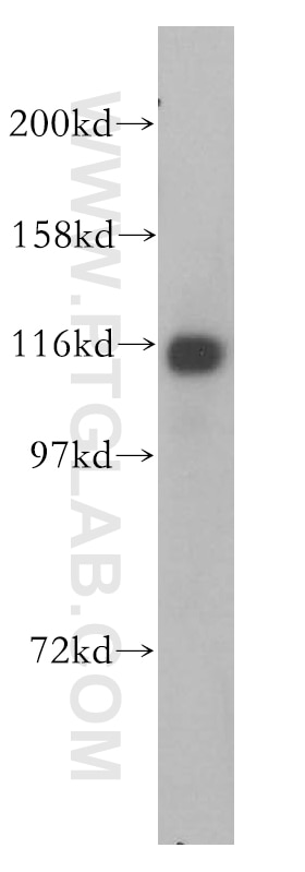 Western Blot (WB) analysis of HepG2 cells using PPFIBP1 Polyclonal antibody (13961-1-AP)