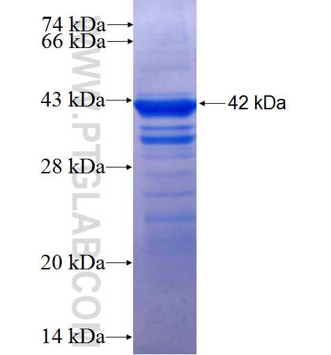 PPFIBP1 fusion protein Ag4884 SDS-PAGE