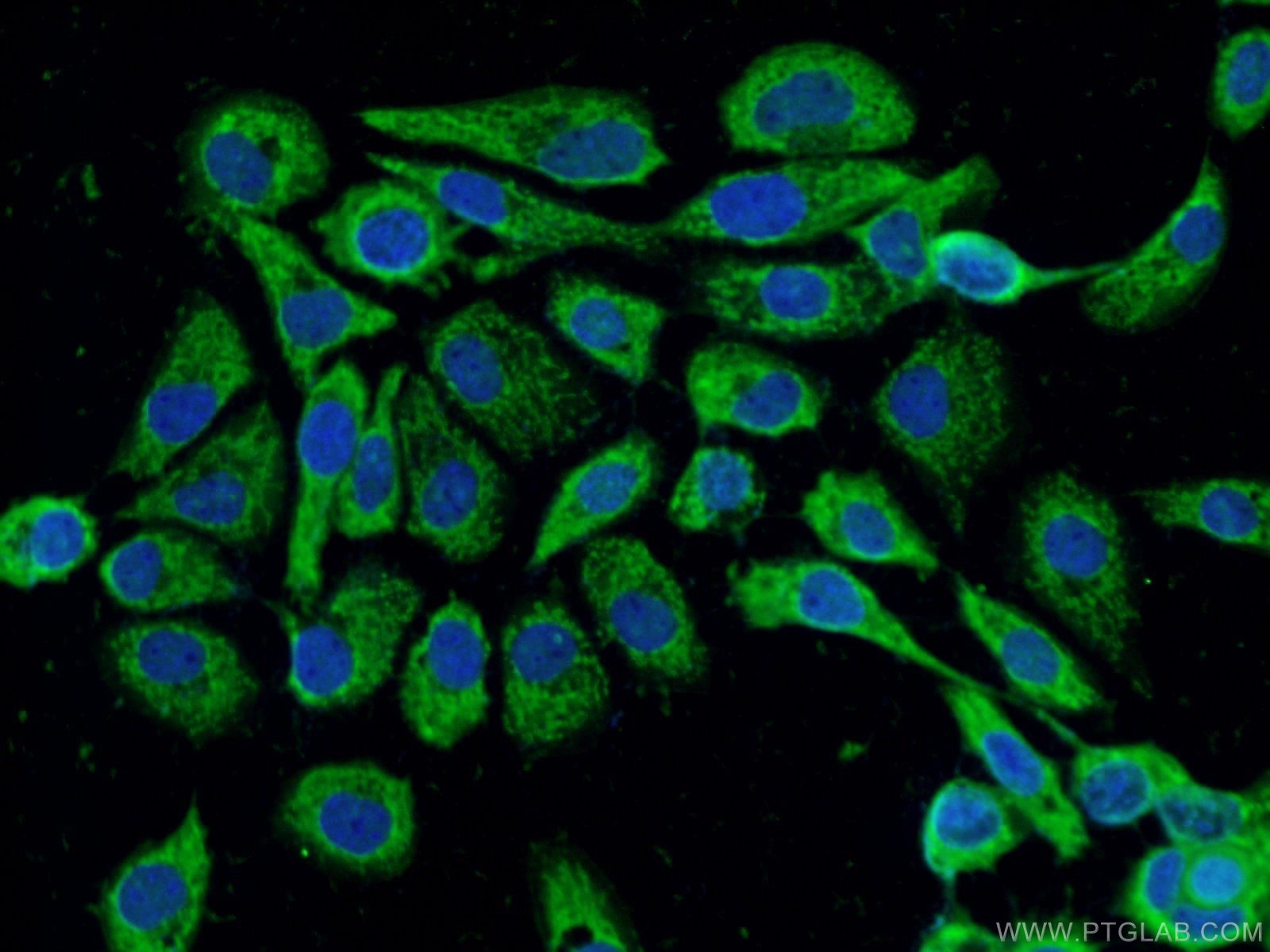 Immunofluorescence (IF) / fluorescent staining of A431 cells using PPFIBP2 Polyclonal antibody (13953-1-AP)