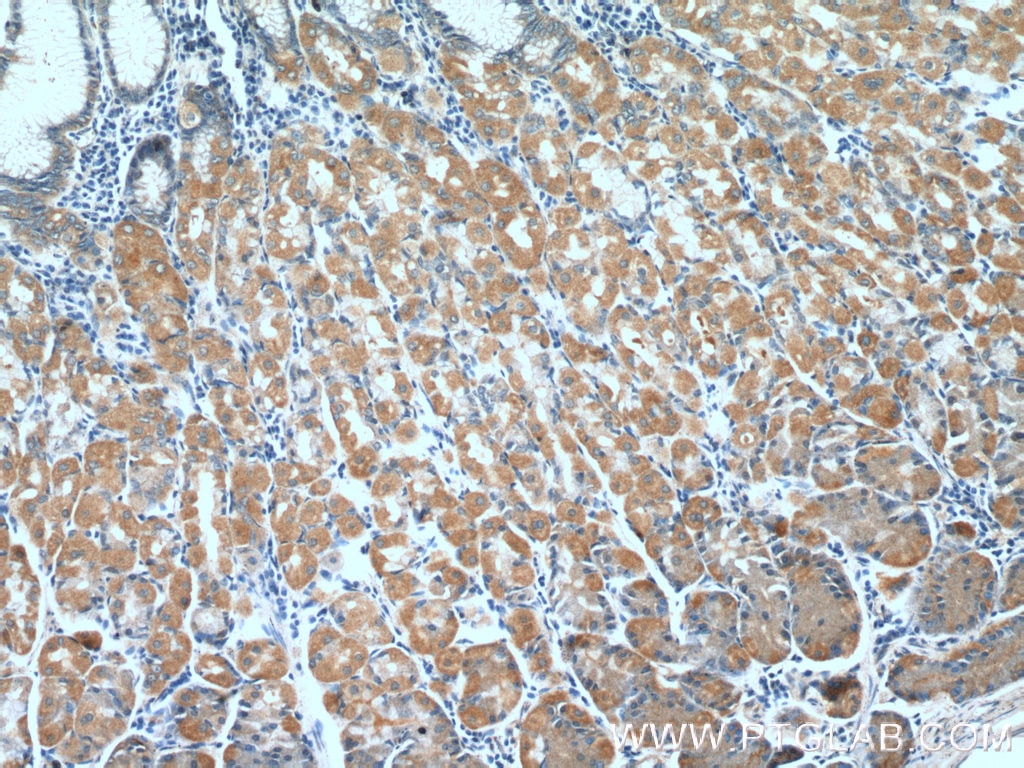 Immunohistochemistry (IHC) staining of human stomach tissue using PPFIBP2 Polyclonal antibody (13953-1-AP)